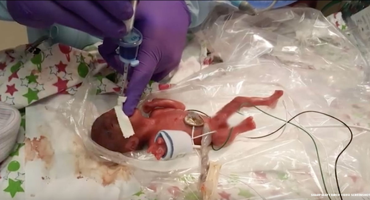 premature baby