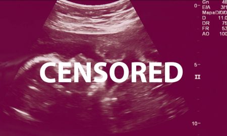 ultrasound, censored, Pinterest