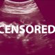 ultrasound, censored, Pinterest