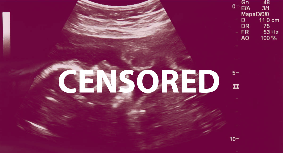 ultrasound, censored, Pinterest