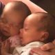 twins saved abortion pill reversal