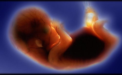 Could ‘exceptions’ to protecting all preborn children destroy every pro-life law?
