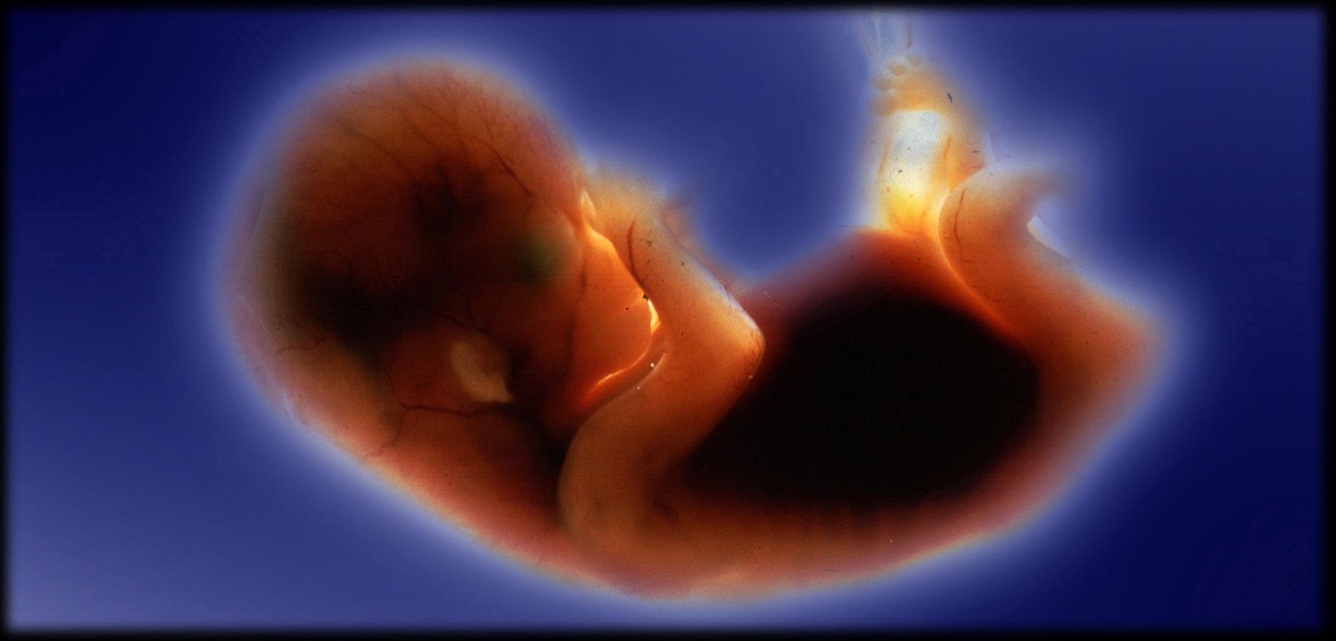 Picture of a human foetus, 14 July 1999. SMH Picture by MICHELE MOSSOP