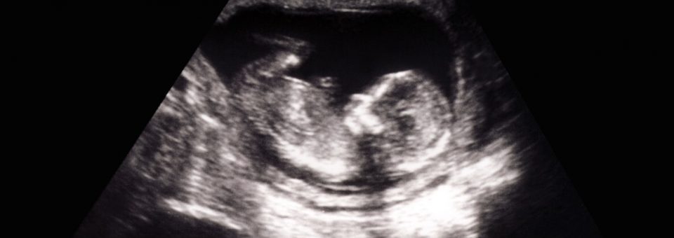 pro-life, Georgia heartbeat, abortion restrictions