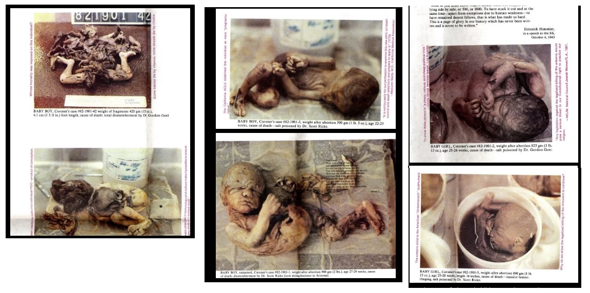 Image: American Holocaust aborted babies found in storage container