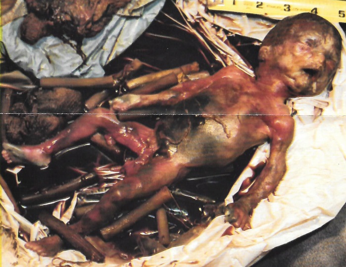 Image: Third trimester aborted babies found in Houston 2