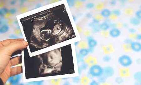 ultrasound, aborted, late-term, abortions