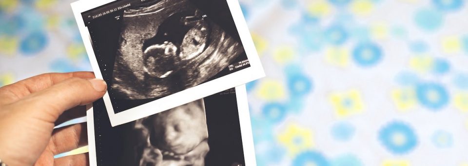 ultrasound, aborted, late-term, abortions