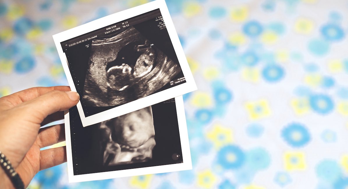 ultrasound, aborted