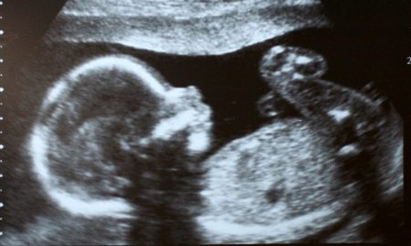 Mexico, abortion, ultrasound, prenatal diagnosis, Virginia, poll
