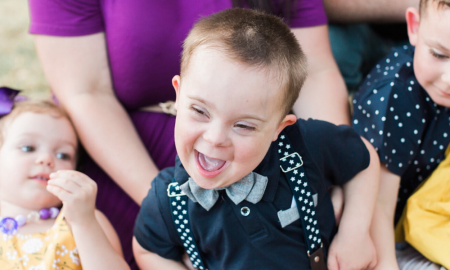 Down syndrome