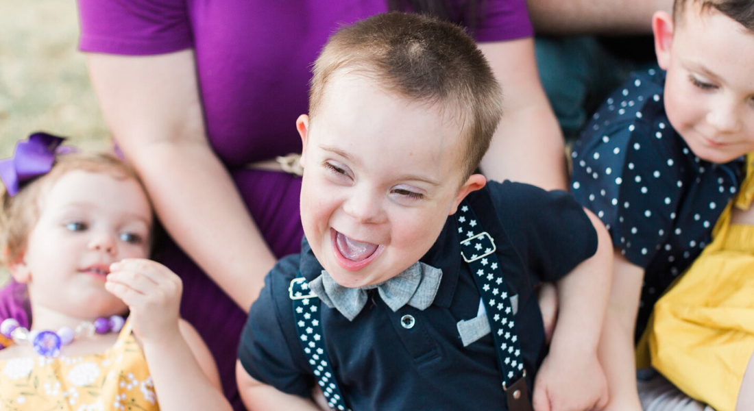 Down syndrome