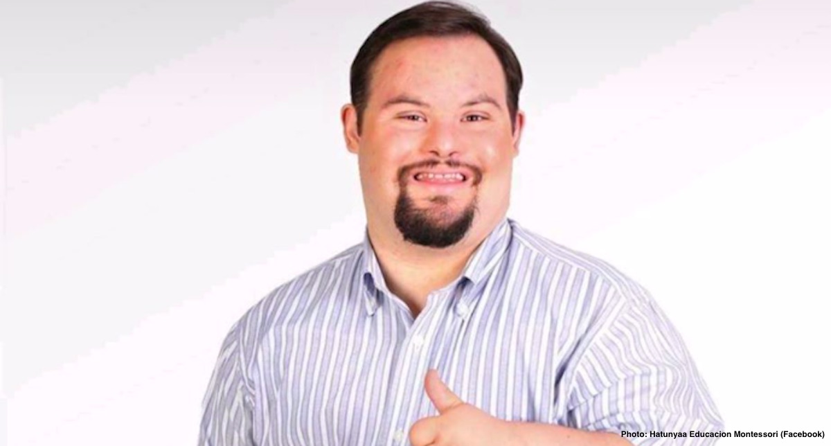 Down syndrome