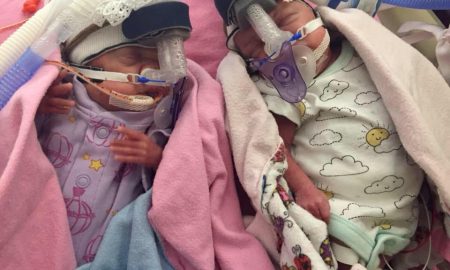 via Facebook, premature, twins, 22 weeks
