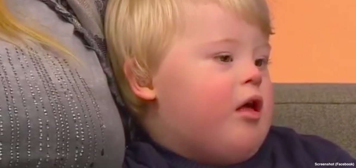 Down syndrome