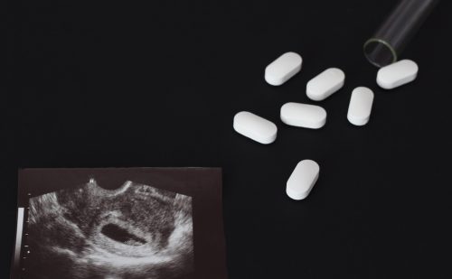 Some want the US to be like Sweden, aborting babies by pill though old enough to survive