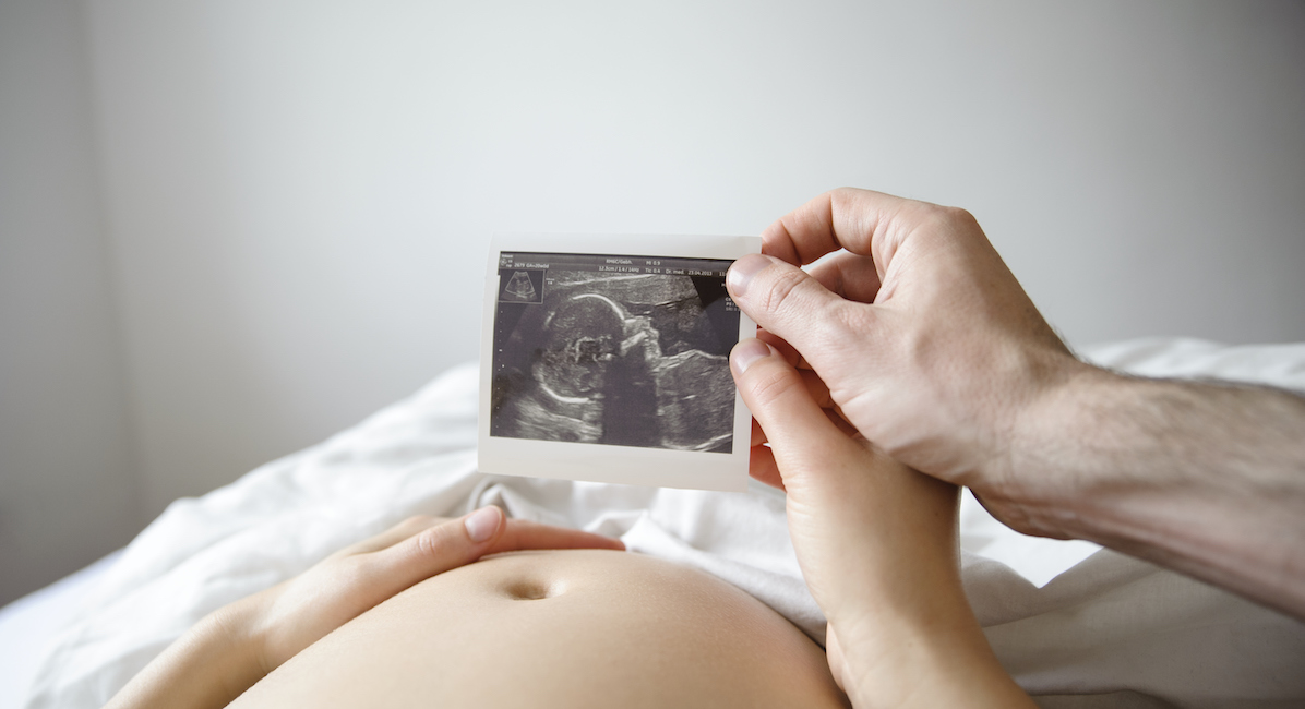 Pregnant woman and man looking at ultrasound