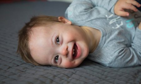 Down syndrome, down syndrome abortion ban