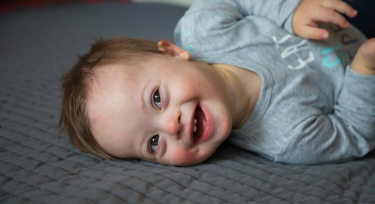 Down syndrome, down syndrome abortion ban, West Virginia
