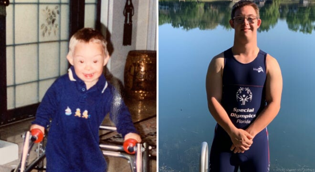 Down syndrome, Ironman