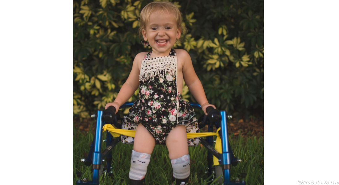 spina bifida