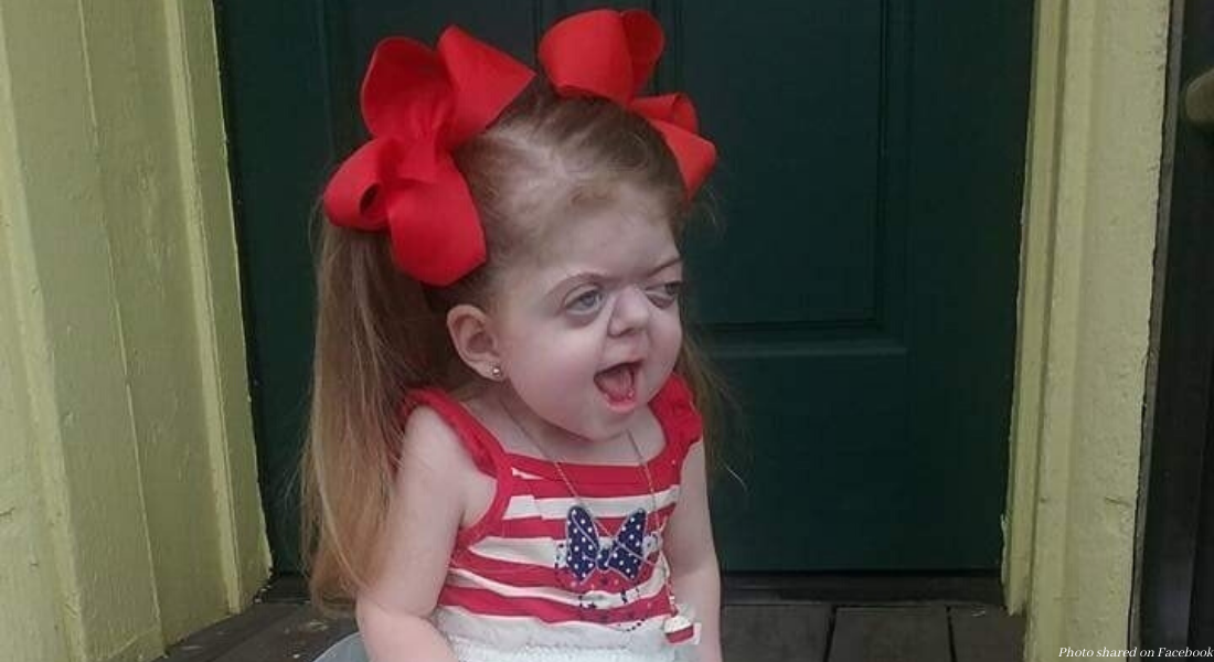 cloverleaf skull, Layla Shook