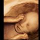 28 week abortion pill death, third-trimester