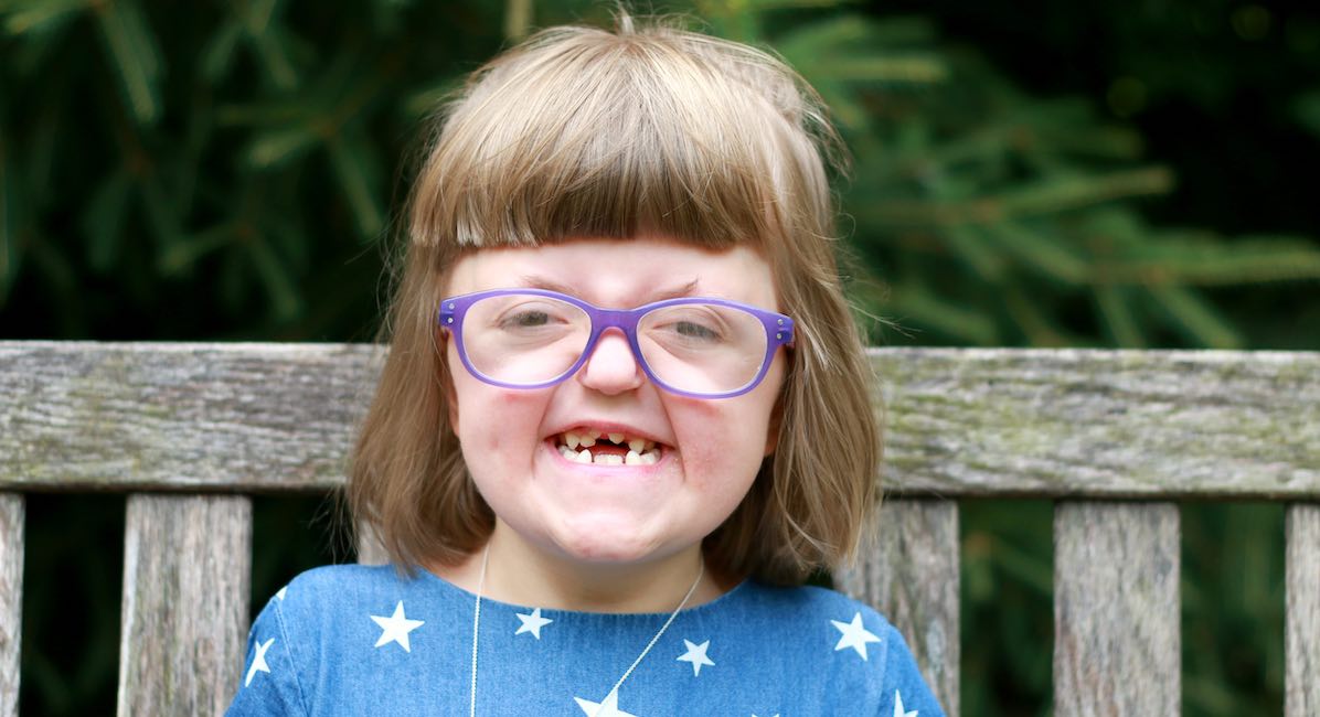 Sarah, craniofacial abnormalities, Apert syndrome