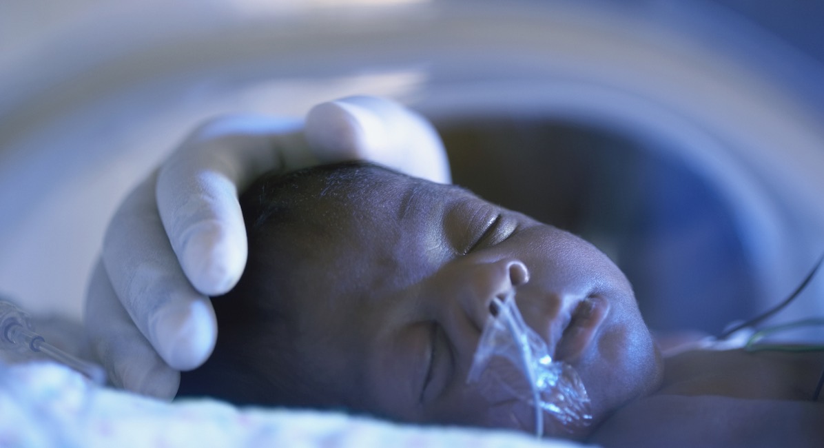 Close up of African American premature baby