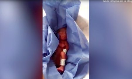 Preemie, mexico