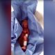 Preemie, mexico