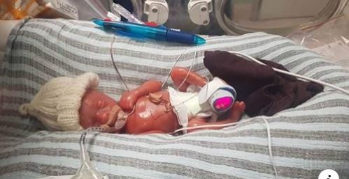 baby premature nine oz hospital born months weighing leaves after right weeks