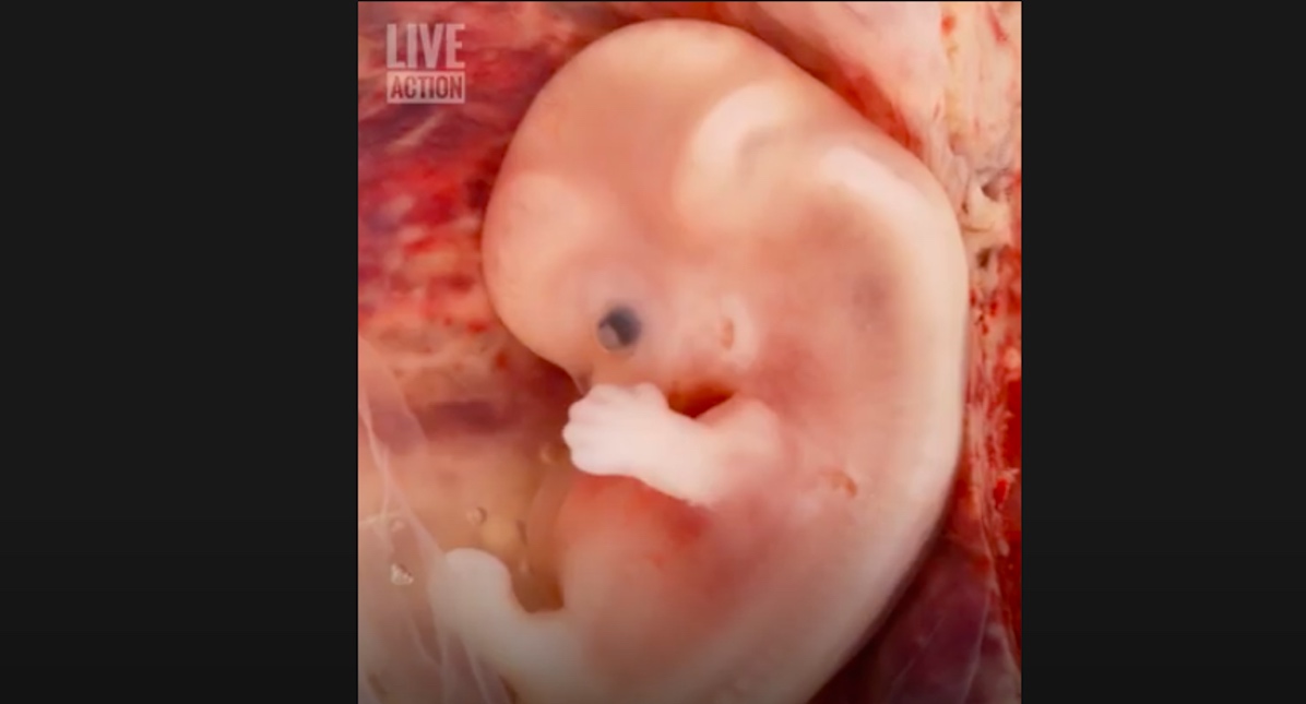 screenshot live action video first trimester