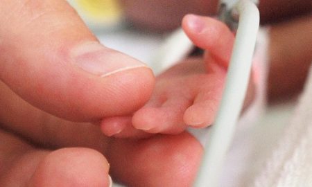 preemie, premature, abortion survivor, born alive