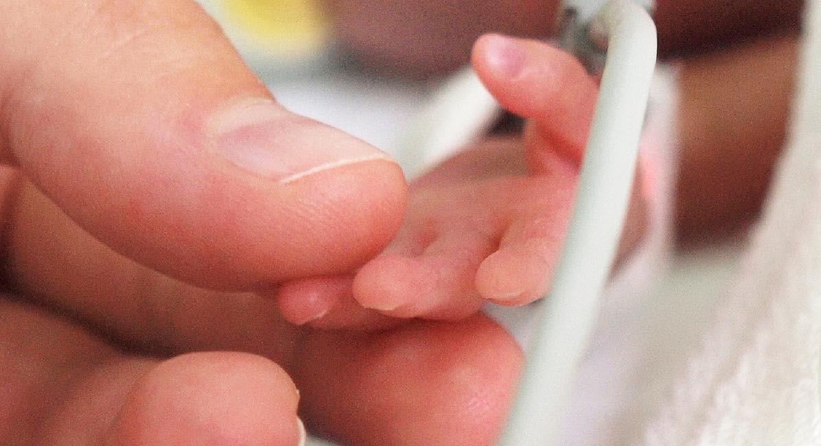 Micro-preemie born at 23 weeks beats the odds