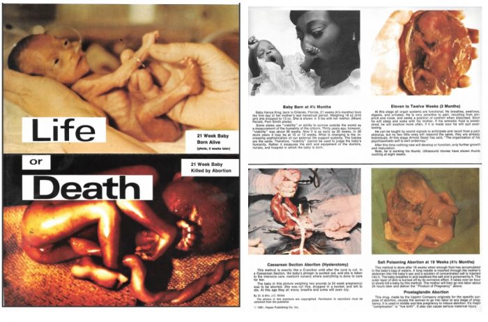 Image: Vintage pro-life brochure "Life and Death" shows graphic abortion victim imagery.