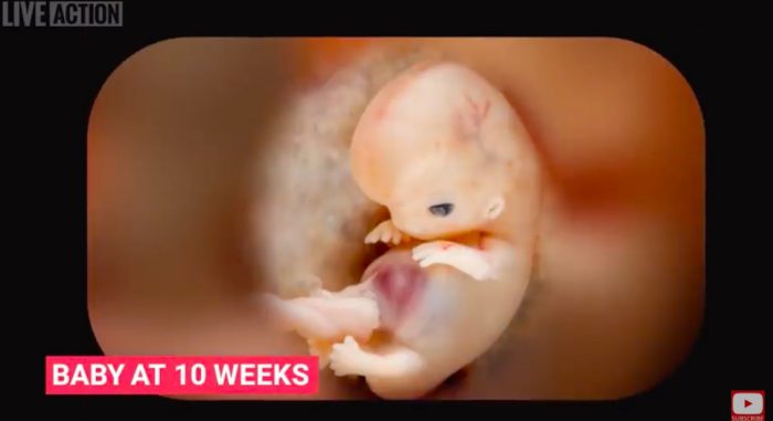10 weeks, pro-life, exceptions