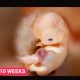 10 weeks, pro-life, exceptions, abortion pill