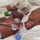 micro-preemie, premature