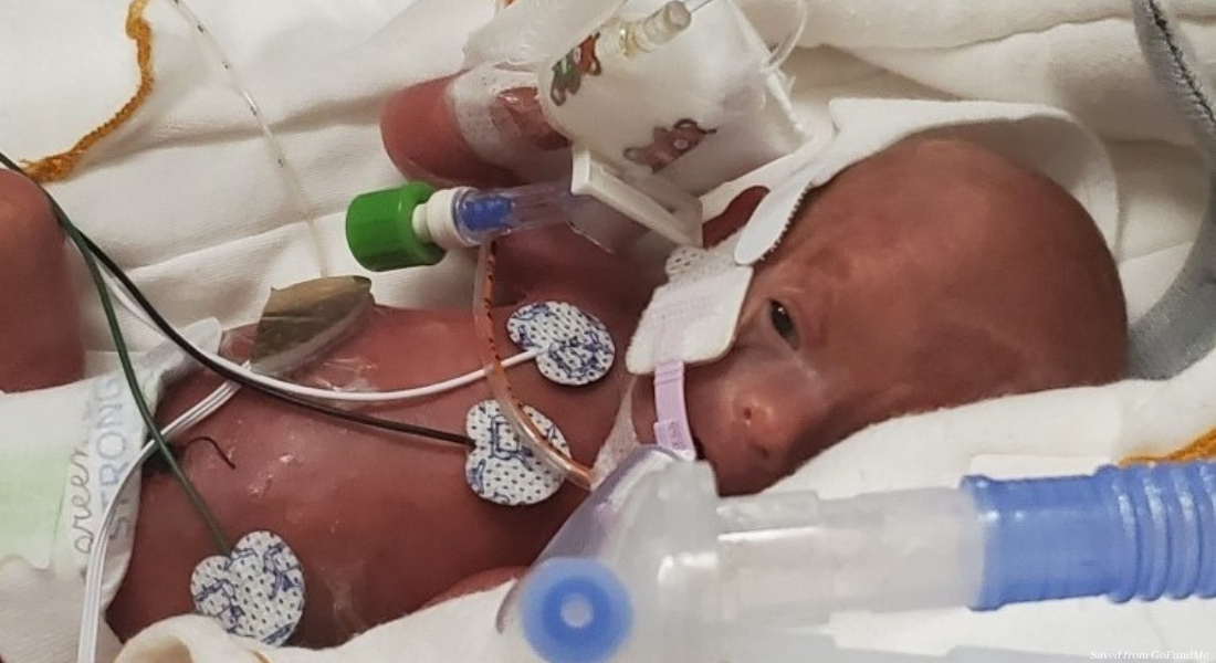 micro-preemie, premature