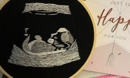 embroidered ultrasound