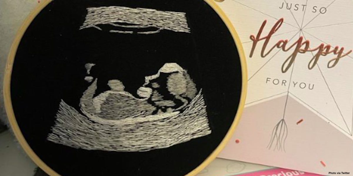 embroidered ultrasound