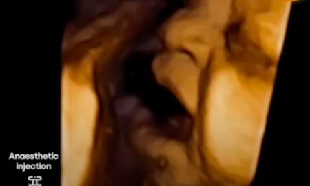 third trimester