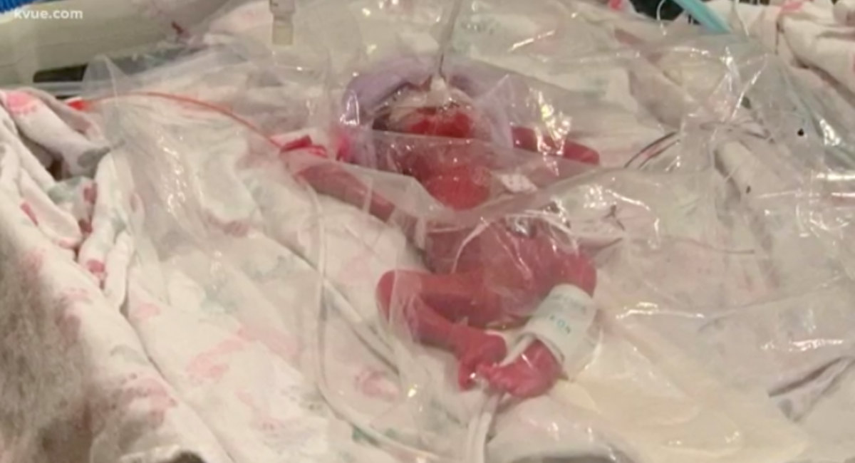 preemie, NICU, Texas