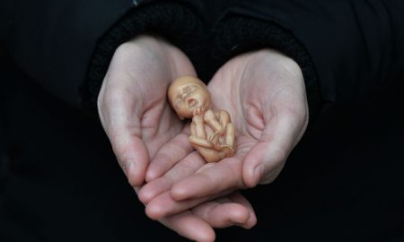 12-week fetal model, Northern Ireland, UK, abortion