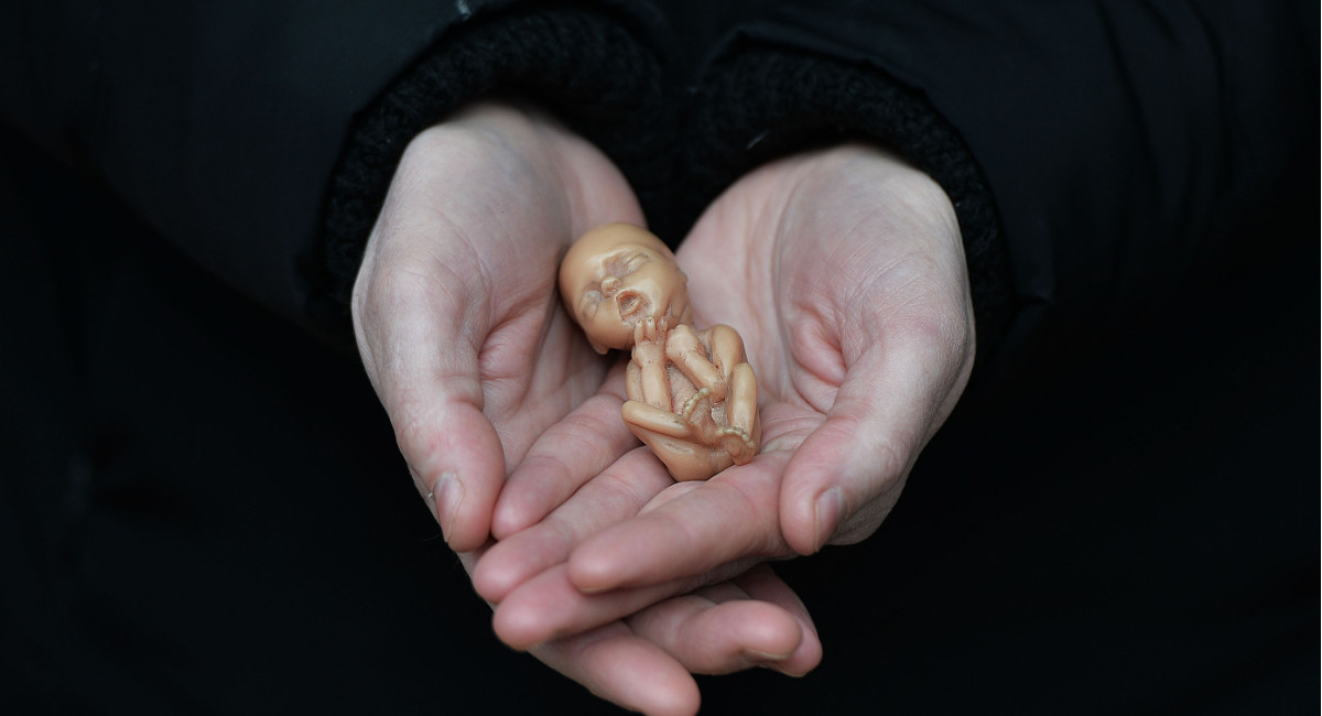 12-week fetal model, Northern Ireland, UK, abortion