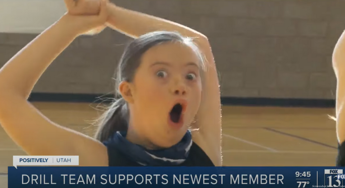 Down syndrome