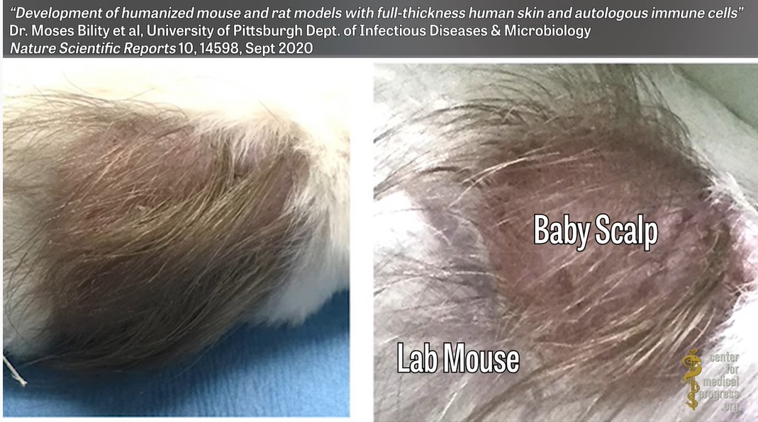 Image: University of Pittsburgh study uses scalps of aborted babies on rodents (CMP vid) 