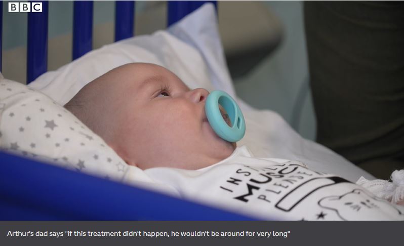 SMA, spinal muscular atrophy