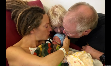 Trisomy 18